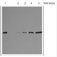 RPS1 | 30S ribosomal protein S1 in the group Antibodies Plant/Algal / DNA/RNA/Cell Cycle / Translation at Agrisera AB (Antibodies for research) (AS08 309)